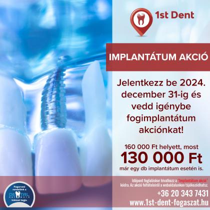 Implantátum Akció