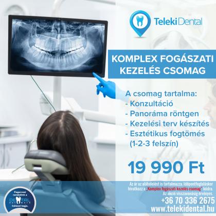 Komplex fogászati kezelés csomag