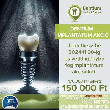 Implantátum akció