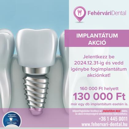 Implantátum Akció