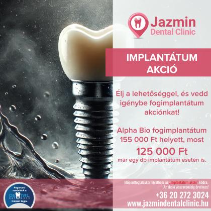 Implantátum akció