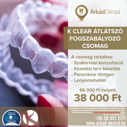 K Clear átlátszó fogszabályozó csomag