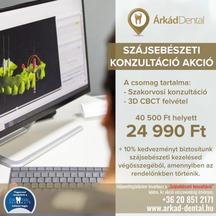 Szájsebészeti konzultáció akció